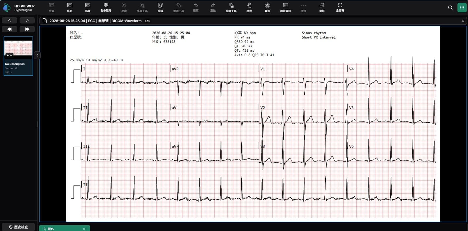 雲智 Web Viewer:DICOM-Waveform 十二導程心電圖
