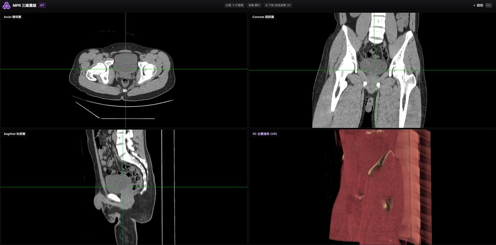 雲智 Web Viewer:MPR 三維重組與 3D 立體渲染